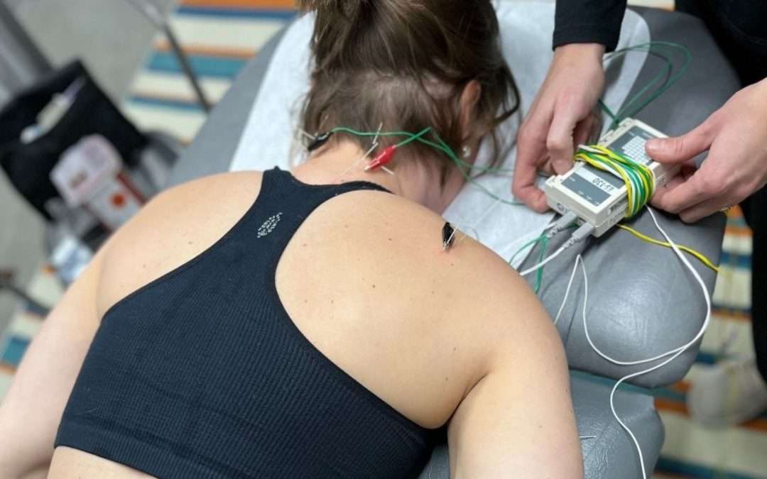 Everything You Need to Know About Dry Needling
